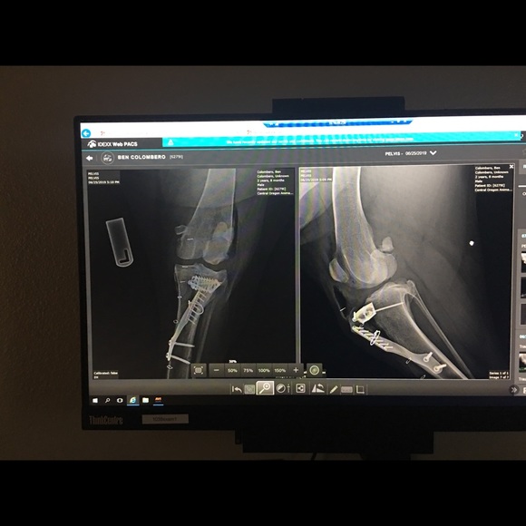 CrAzy Dog Lady! 🐶💖🐾 - Picture 3 of 16